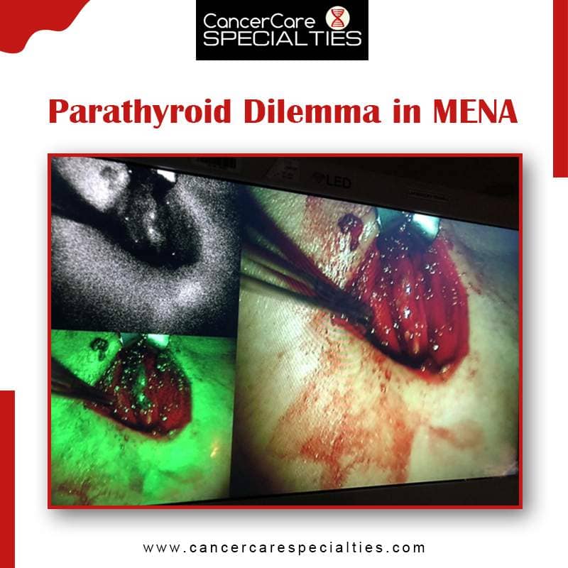 Parathyroid Dilemma in MENA